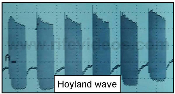 Philip Hoyland's Waveform